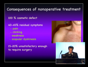 screenshot of Dr. Struhl's Shoulder Course Presentation on Closed-Loop Double Endobutton Reconstruction for Acromicoclavicular Joint Separation