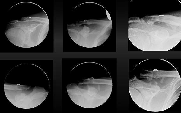 Group Post-op X-rays 