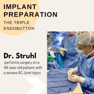 Dr. Struhl during implant preparation with triple endobutton technique. Dr. Struhl performs surgery on a 48-year old patient with a severe AC joint injury